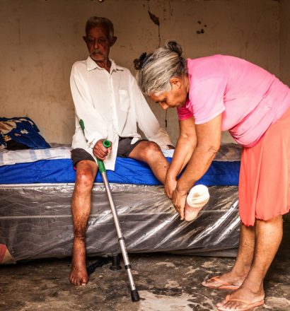 A person affected by leprosy from Brazil with numb feet due to leprosy complications gets new bandages from his wife