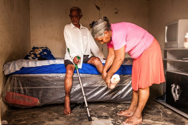 A person affected by leprosy from Brazil with numb feet due to leprosy complications gets new bandages from his wife