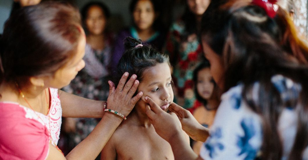 Leprosy doctor checks a young child on symptoms of leprosy