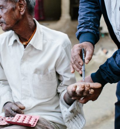 Rameswor, a person affected by leprosy, has numb hands due to leprosy complications