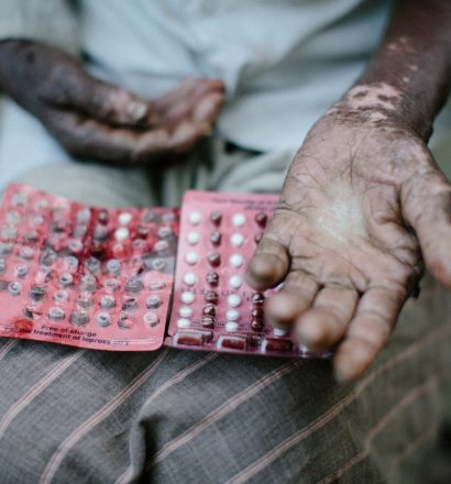 Medication for Rameswor, a person affected by leprosy