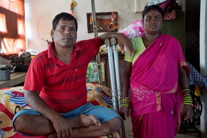 Nepalese man with leprosy walks on crutches