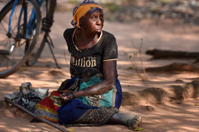 Woman affected by leprosy in Mozambique